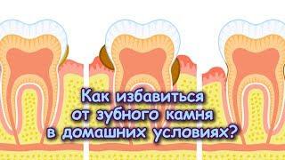 Как ИЗБАВИТЬСЯ от ЗУБНОГО КАМНЯ в домашних условиях?